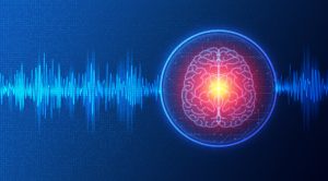 Neuromodulation and Neurostimulation - Alteration of Nerve Activity Through Targeted Delivery of a Stimulus - Conceptual Illustration